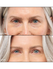 Revitalize Hydra Concealer