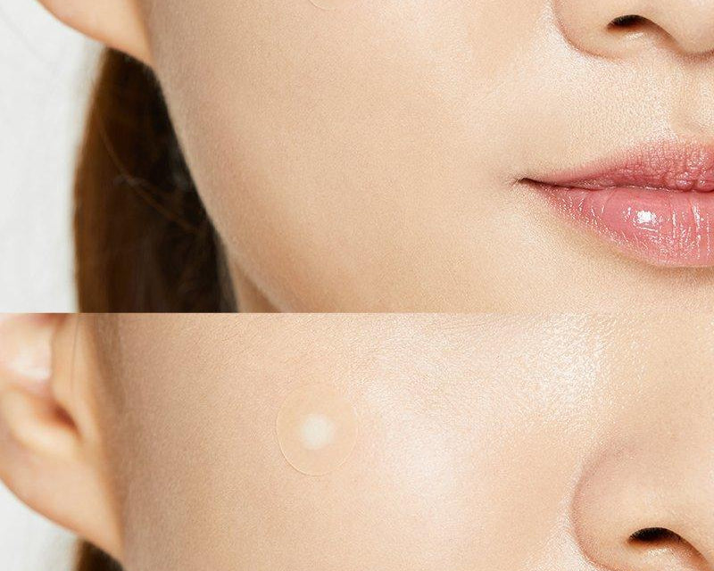 acne-pimple-master-patch-cosrx-official-5_1296x_a169a522-d701-4509-975b-e472acbfc4f9.jpg